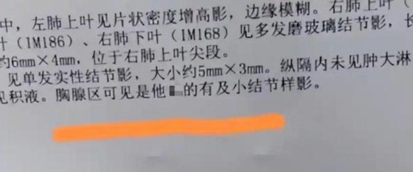 CT检查报告出现不文明用语